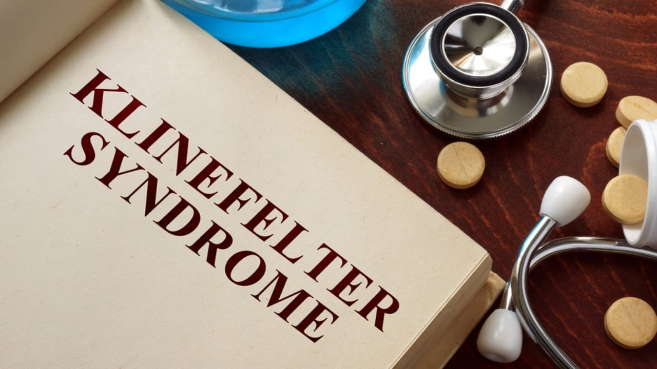 The Reality of 'Down Syndrome' in Animals: 12 Key Facts 10 The Reality of 'Down Syndrome' in Animals: 12 Key Facts - klinefelter syndrome dp83825794