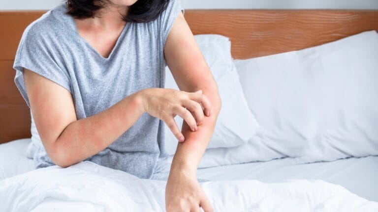 15 Scents Bed Bugs Hate—and How to Use Them - woman bed bugs ss2369156583 degm