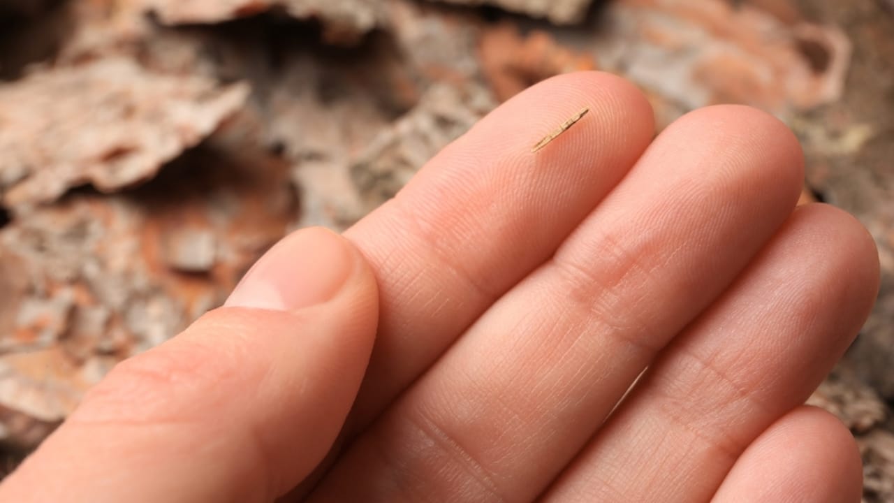 15 Ingenious Life Hacks from 100 Years Ago That Still Work 3 15 Ingenious Life Hacks from 100 Years Ago That Still Work - woman with splinter in her finger ss2275784915 dpdgm