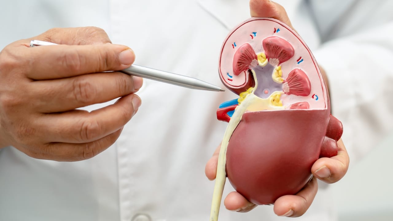 Two Ingredients, Endless Benefits: Lemon-Turmeric Water 9 Two Ingredients, Endless Benefits: Lemon-Turmeric Water - Prevents Kidney Stones dp664905460 dnoh