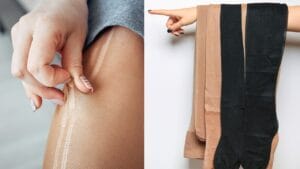 Don’t Toss Them... 15 Creative Ways to Reuse Pantyhose 1 Don’t Toss Them... 15 Creative Ways to Reuse Pantyhose - ripped nylon pantyhose ss1298241298 1298241298 degm
