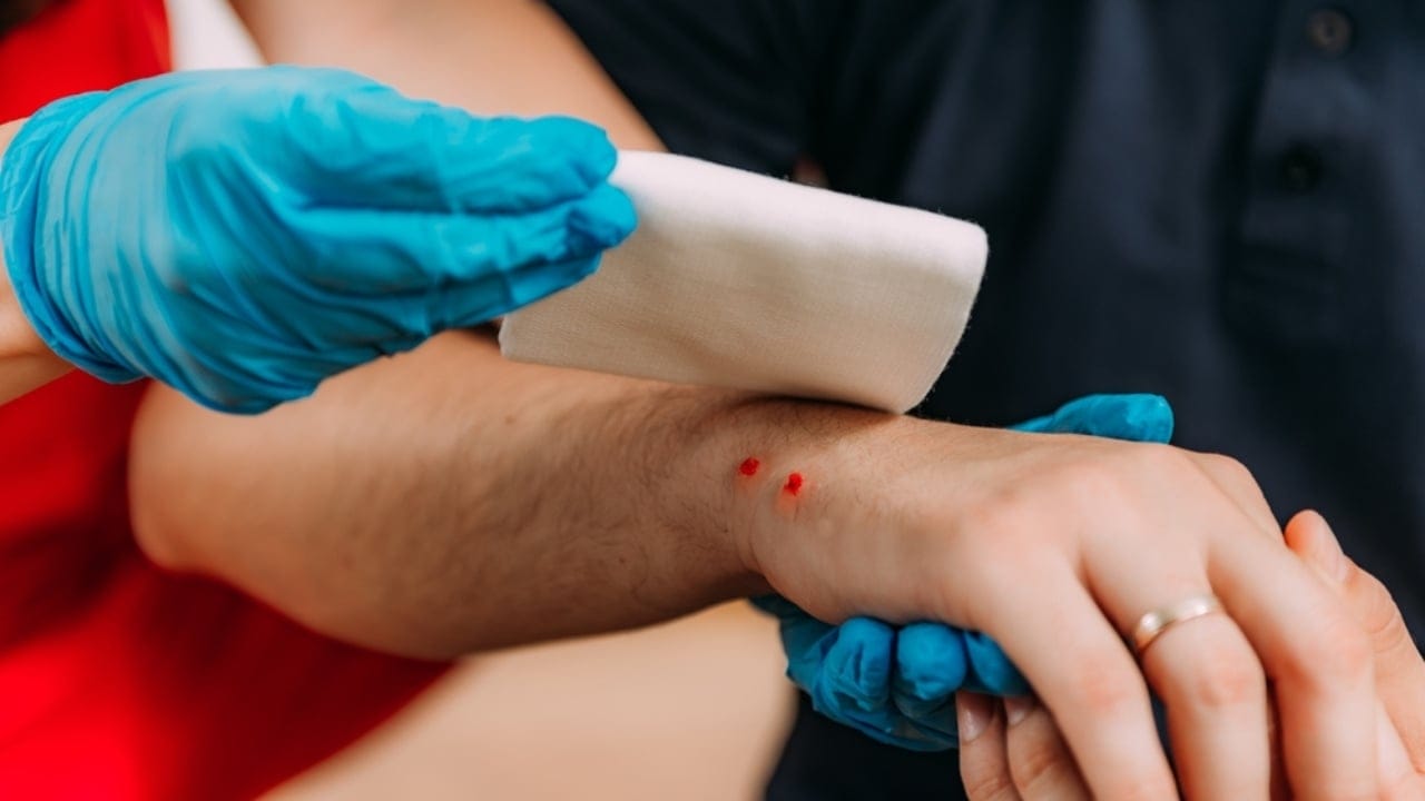 15 Survival Myths That Could Cost You Your Life 2 15 Survival Myths That Could Cost You Your Life - snake bite ss2370549787 dnoh